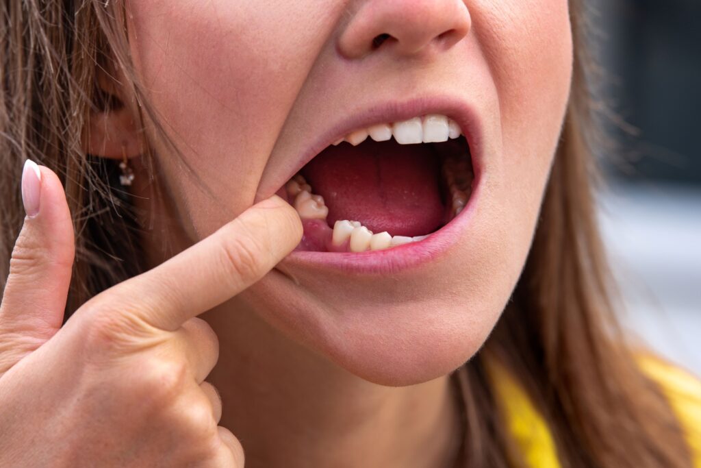 Nose-to-neck view of woman pulling down lower lip to reveal gap in her grin
