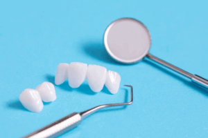 Two dental bridges resting on a blue surface next to dental tools